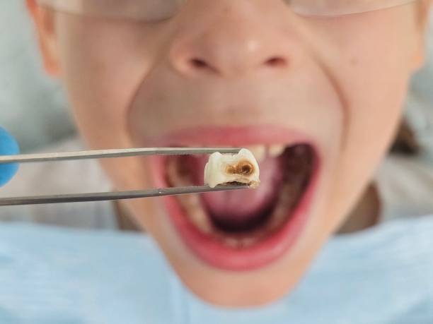 Best Emergency Dental Services for Seniors in Inkerman, PA