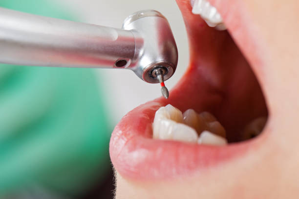 Best Emergency Dental Extractions in Inkerman, PA